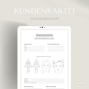 Puede incluir: Una tarjeta de cliente imprimible en blanco y negro para tratamientos de microneedling. La tarjeta incluye secciones para los detalles del cliente, el tipo de microneedling, las áreas tratadas, el plan de tratamiento y los resultados.