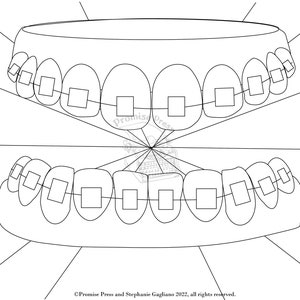 Intención para colorear: página para colorear de aparatos dentales para guardar para aparatos dentales o trabajos dentales