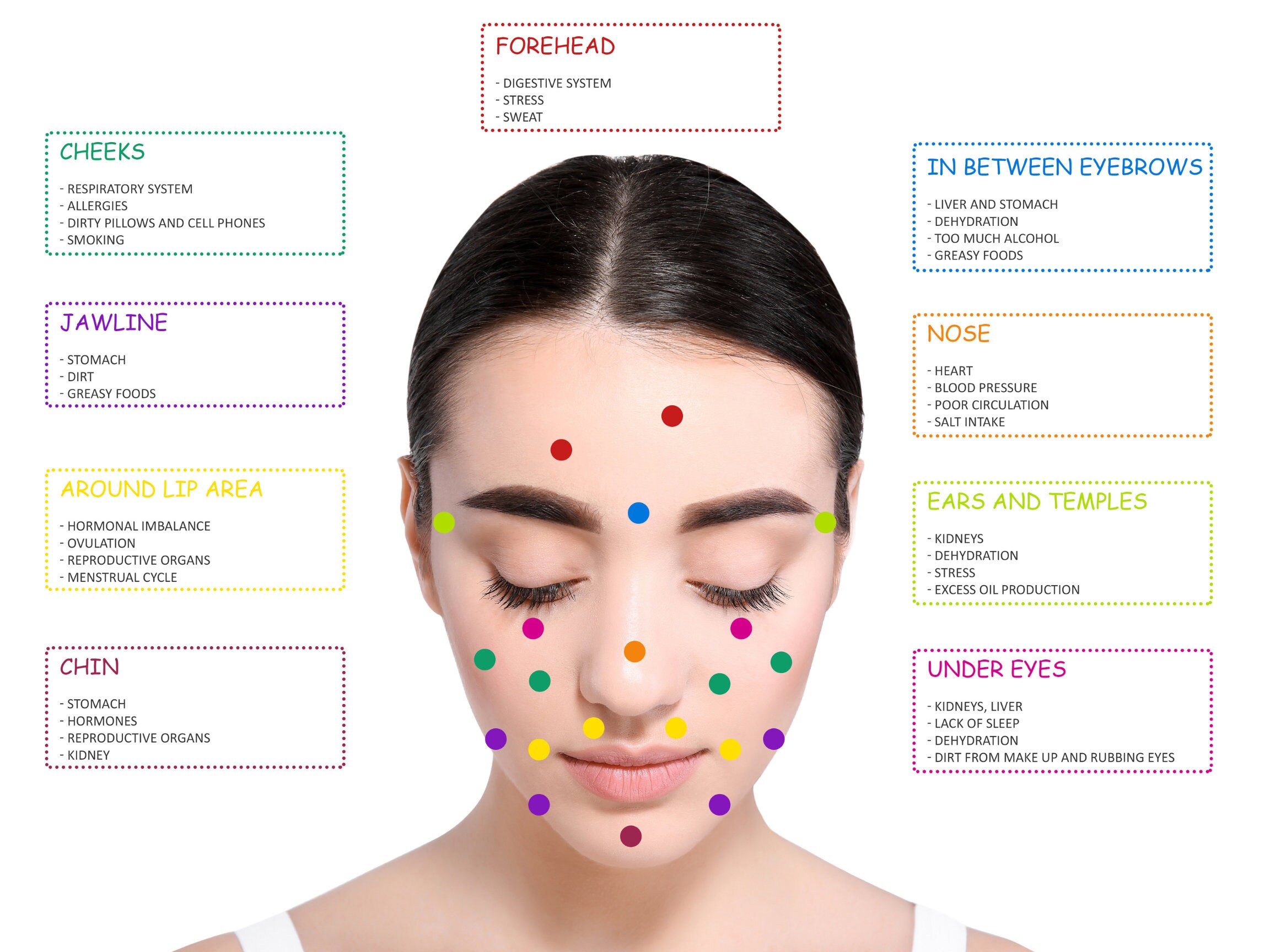 Acne Face Map Detailed Poster Size 24x18 Etsy Acne Face Map Detailed Poster Size 24x18 Etsy