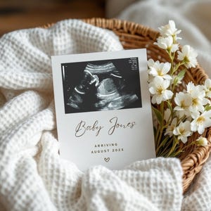 Minimalistische Ultraschall Schwangerschaftsankündigung | Neutrale moderne Baby offenbaren | Einfache Blumen Digitaler Download | Digitale Schwangerschaft