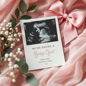 Rosa Baby Mädchen Ankündigung Vorlage | Schwangerschaft Ultraschall Digital Reveal | Babymitteilung Baby | Elegante Baby Nachrichten