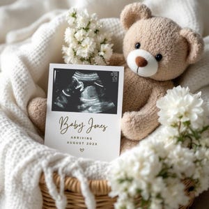 Elegante Schwangerschaftsmitteilungsvorlage | Neutral Frühling Ultraschall Karte | Weiß Blumen Baby offenbaren digitaler Download | Erwarte Baby Nachrichten