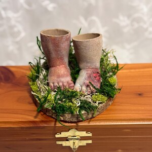 May include: A unique, handmade decorative piece featuring two dismembered legs with exposed feet, set in a bed of green moss on a wooden base. The legs are painted with realistic skin tones and details, with one foot showing a bloody wound.