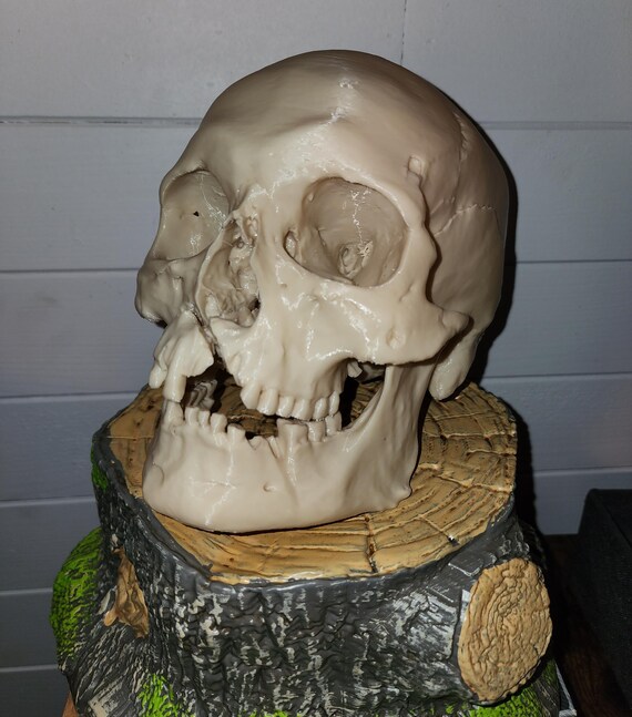 Battle of Visby Skull Replica: 1361 Axe Wound Oddity - Etsy