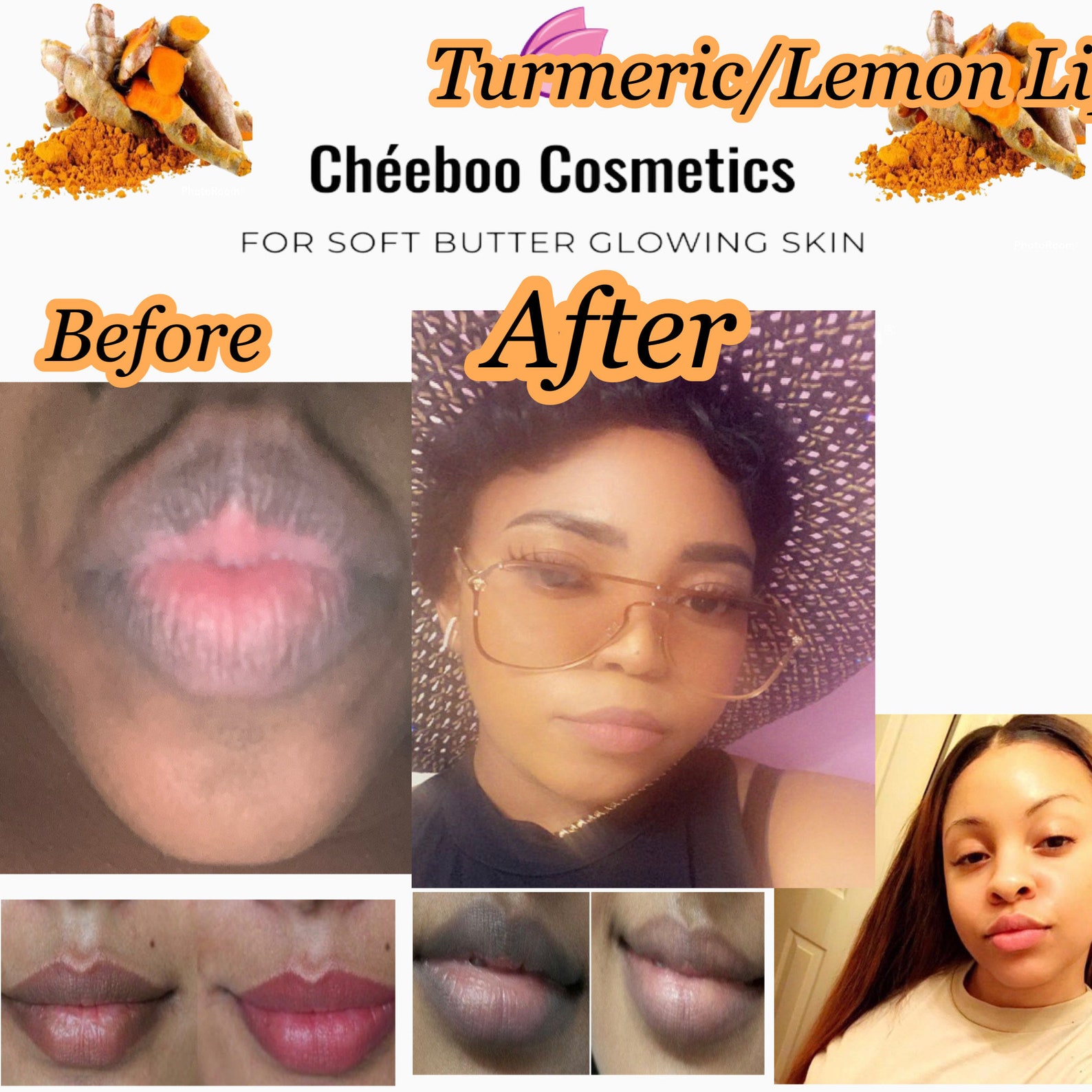Turmeric Lip Lightening Set/lips Lightening Scrub/lips Scrub for Dark