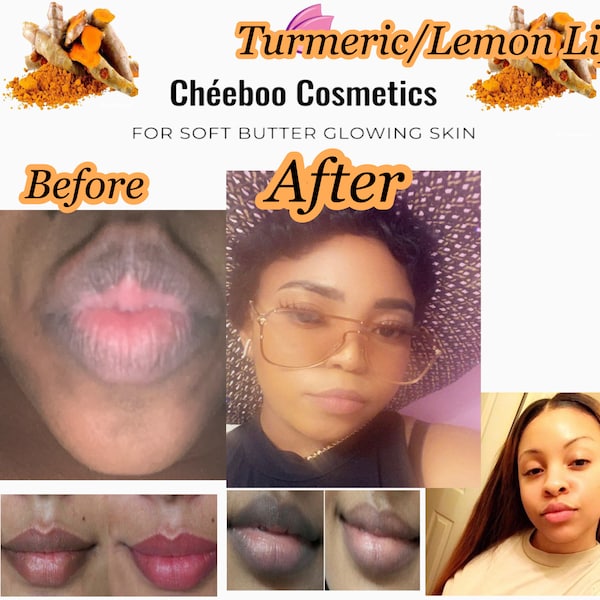 Turmeric Lip Lightening Set/Lips lightening scrub/Lips scrub for dark lips/ smoker’s Lip Scrub/Brightening Lips Balm /dark lips correction/