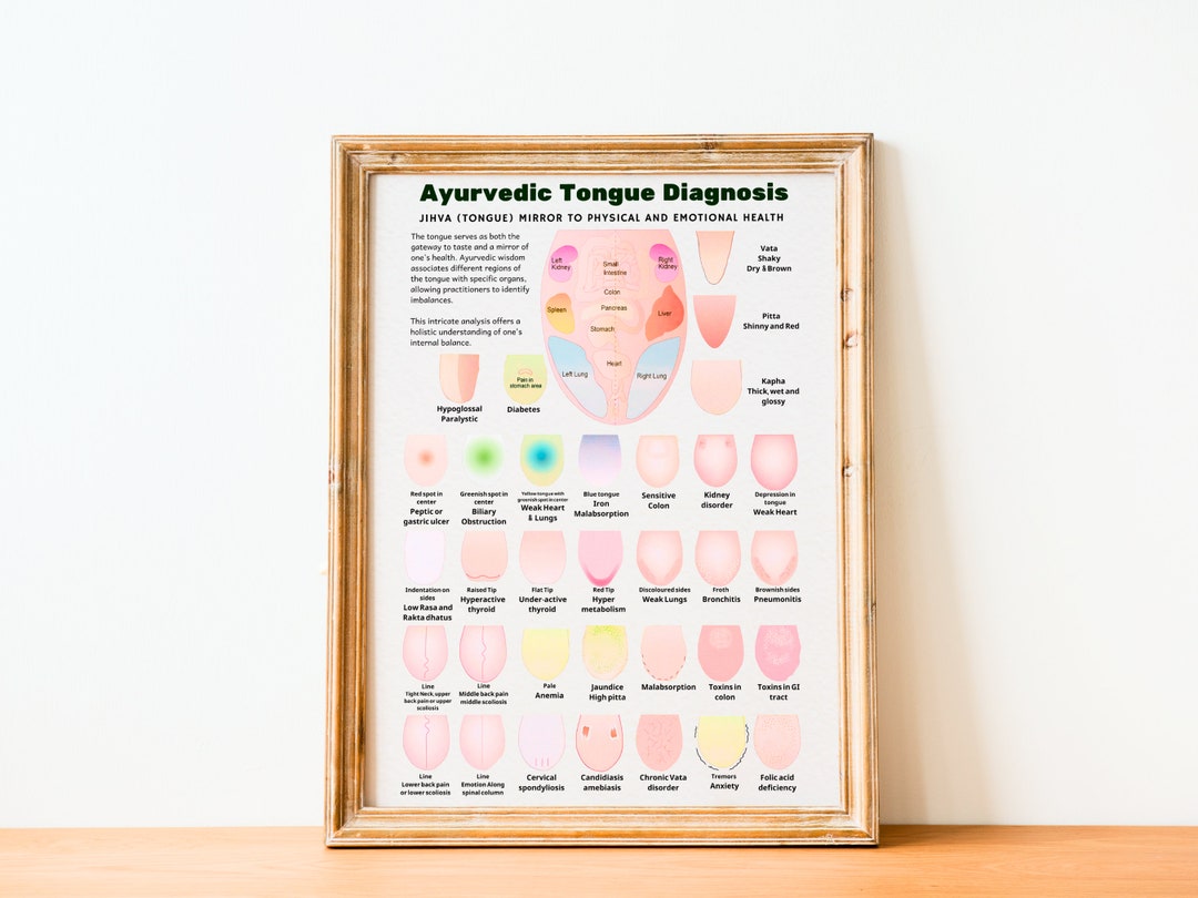 Ayurveda Tongue Diagnosis Poster, Ayurveda Tongue Chart, Ayurveda Art