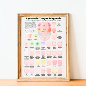 Ayurveda Tongue Diagnosis Poster, Ayurveda Tongue Chart, Ayurveda Art Print, Ayurveda Gifts, Health and Wellness, Digital Ayurveda Art