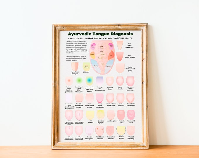 Ayurveda Tongue Diagnosis Poster, Ayurveda Tongue Chart, Ayurveda Art