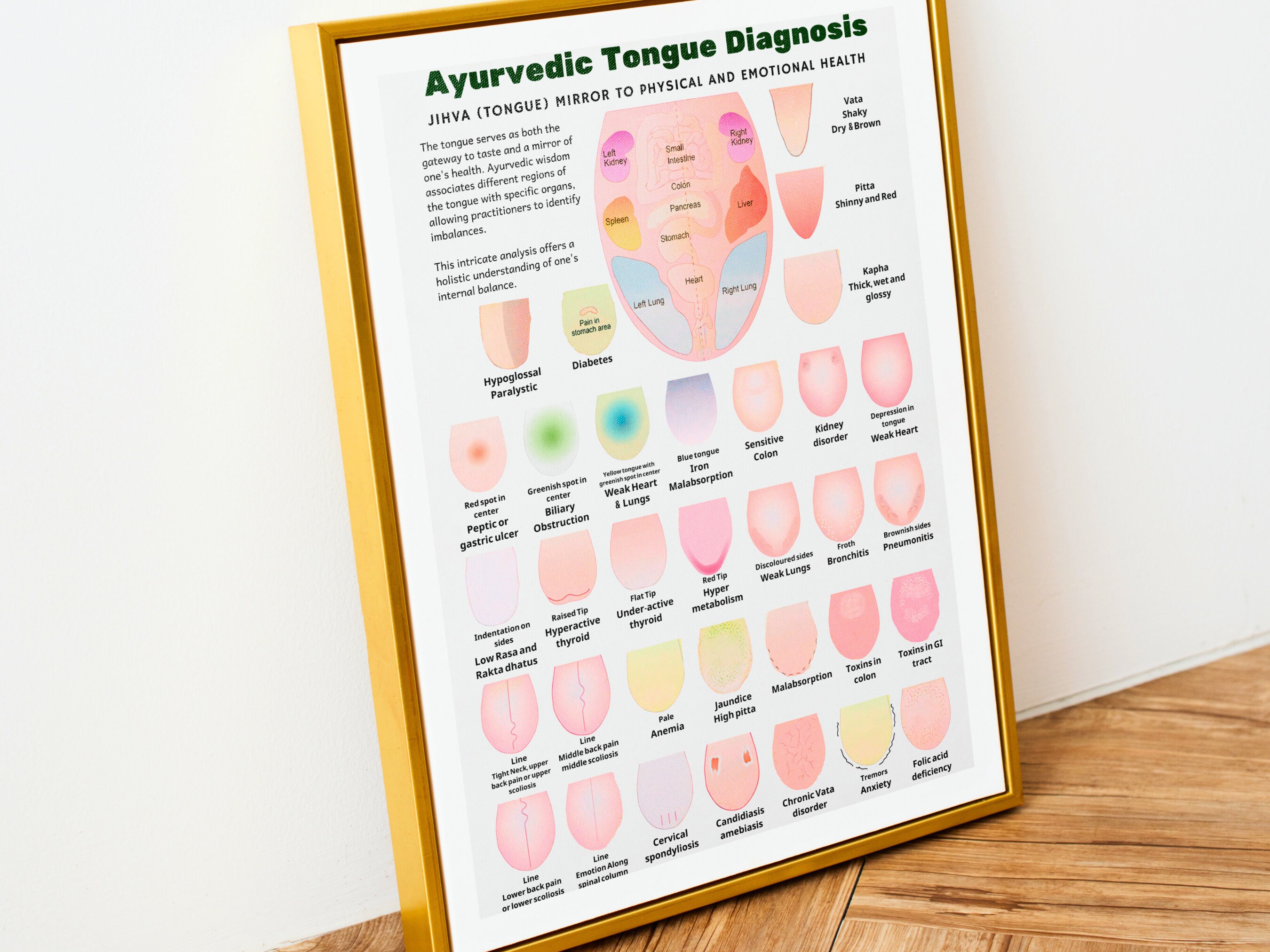 Ayurveda Tongue Diagnosis Poster, Ayurveda Tongue Chart, Ayurveda Art