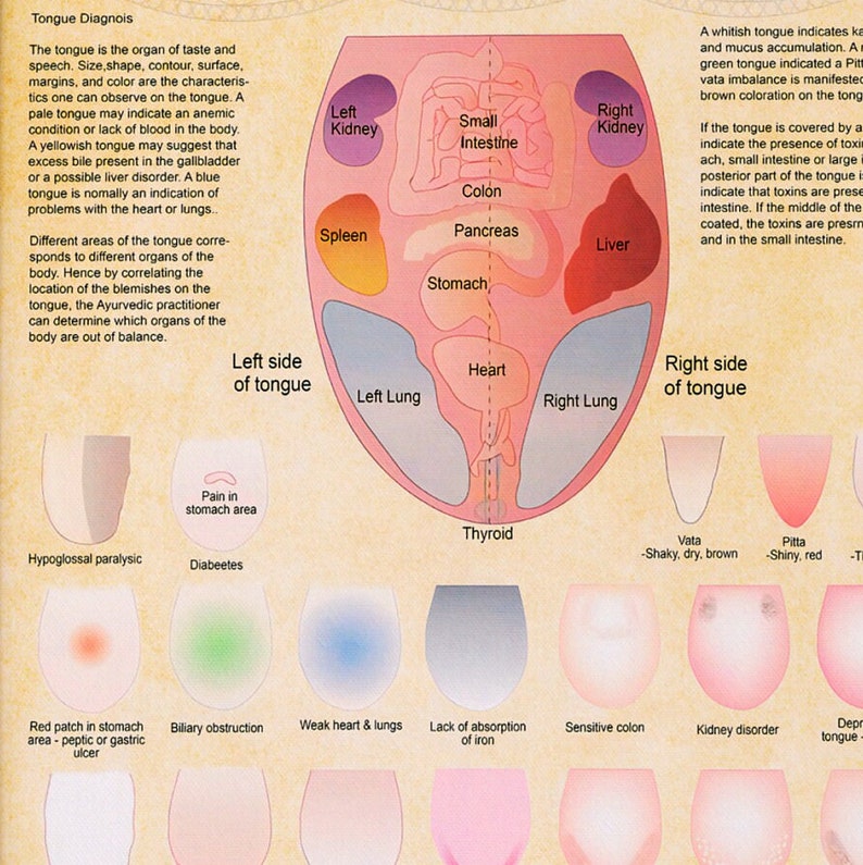 Ayurveda Tongue Diagnosis Poster Ayurveda Tongue Chart Etsy