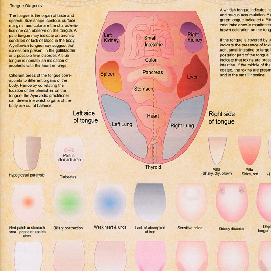 Ayurveda Tongue Diagnosis Poster Ayurveda Tongue Chart Etsy Australia