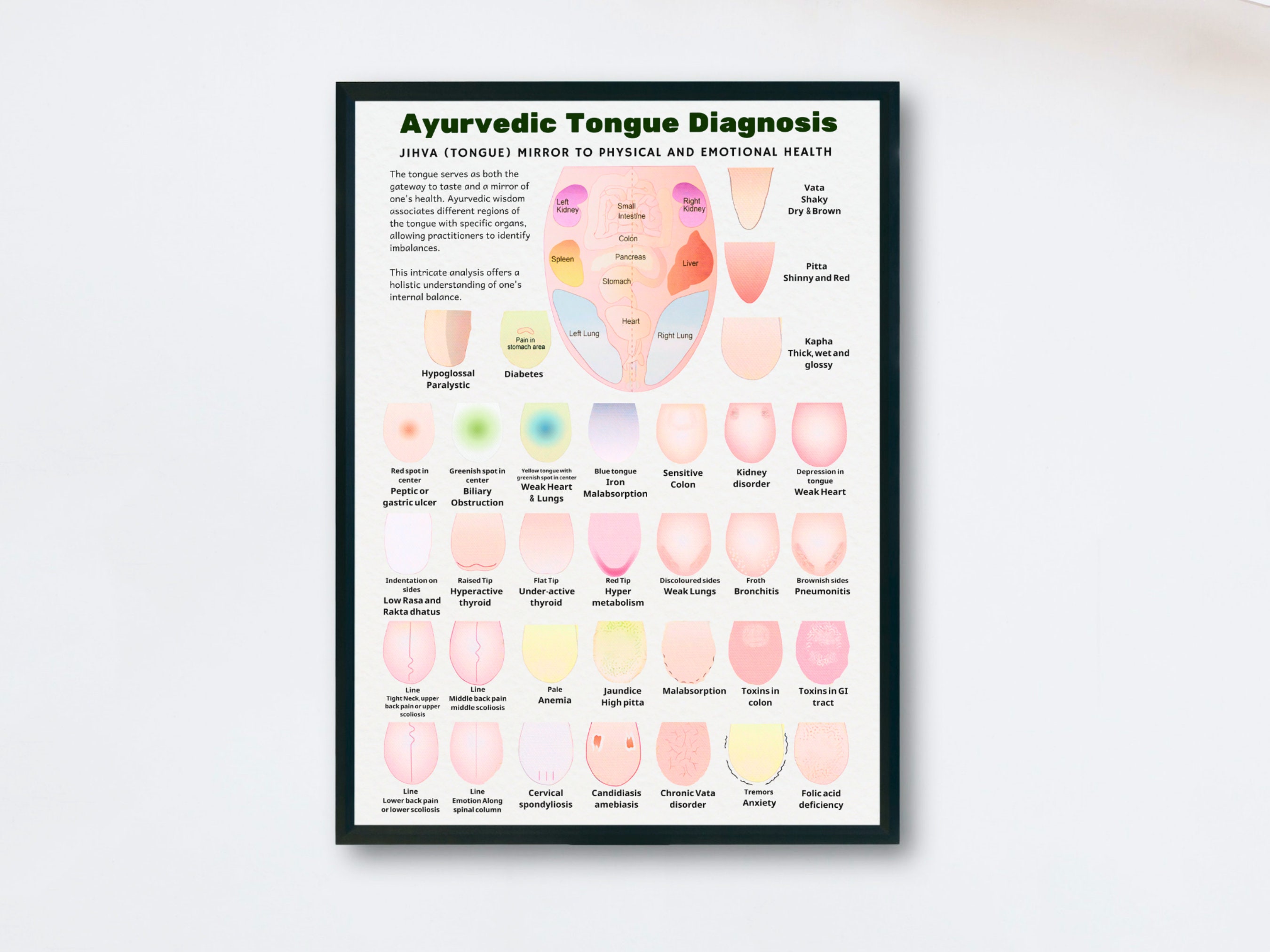 Ayurveda Tongue Diagnosis Poster, Ayurveda Tongue Chart, Ayurveda Art
