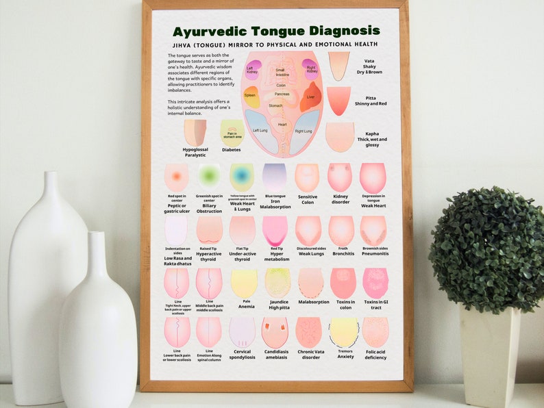Ayurveda Tongue Diagnosis Poster, Ayurveda Tongue Chart, Ayurveda Art Print, Ayurveda Gifts
