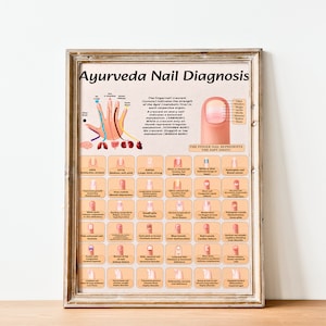 Ayurveda Nail Diagnosis Poster and Book Insert, Ayurveda Nail Chart, Ayurveda Digital Art Print, Ayurveda Gifts, Health and Wellness