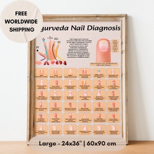 Diagnostic ayurvédique des ongles sur papier mat : des cadeaux de soins personnels confortables, de santé et de bien-être basés sur l'ayurveda pour les yogis et les amateurs de zen. Taille 36 x 24 po.