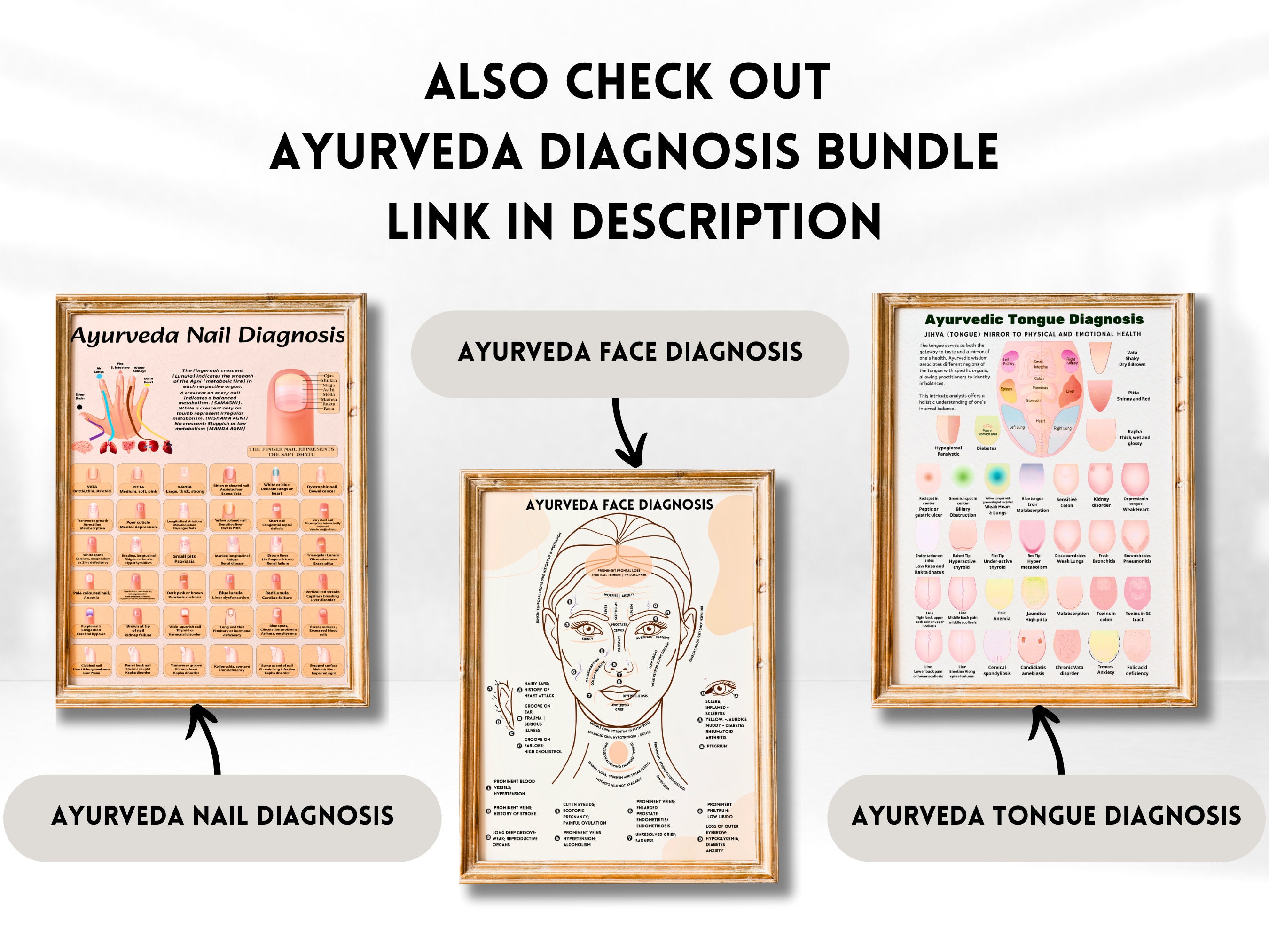 Ayurveda Tongue Diagnosis Poster, Ayurveda Tongue Chart, Ayurveda Art