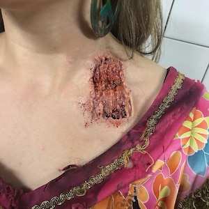 Zombie Bite – 1-Piece Silicone Prosthetic Wound | Syncap Encapsulated | SFX Makeup FX | One-Time Use