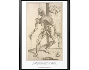Gruesome figure hanging with a noose around its neck framed canvas | Vintage Human Anatomy Posters