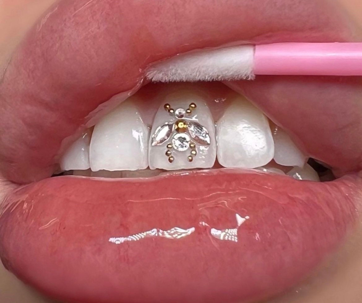 Teeth Gemstone Decorative Glue Tooth Set Diamonds Shiny Crystal Diamond  Teeth Ornament Fixed Lightcure Dental Rhinestone Glue - AliExpress