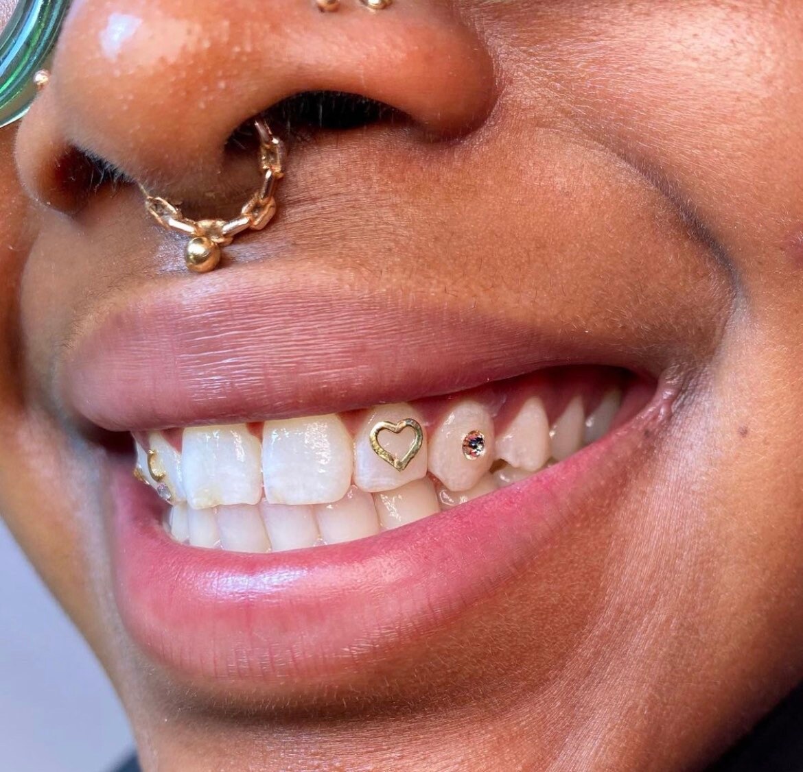 Tooth Gem Adhesive Etch Bonding Composite A2 LED LIGHT for Tooth Gem