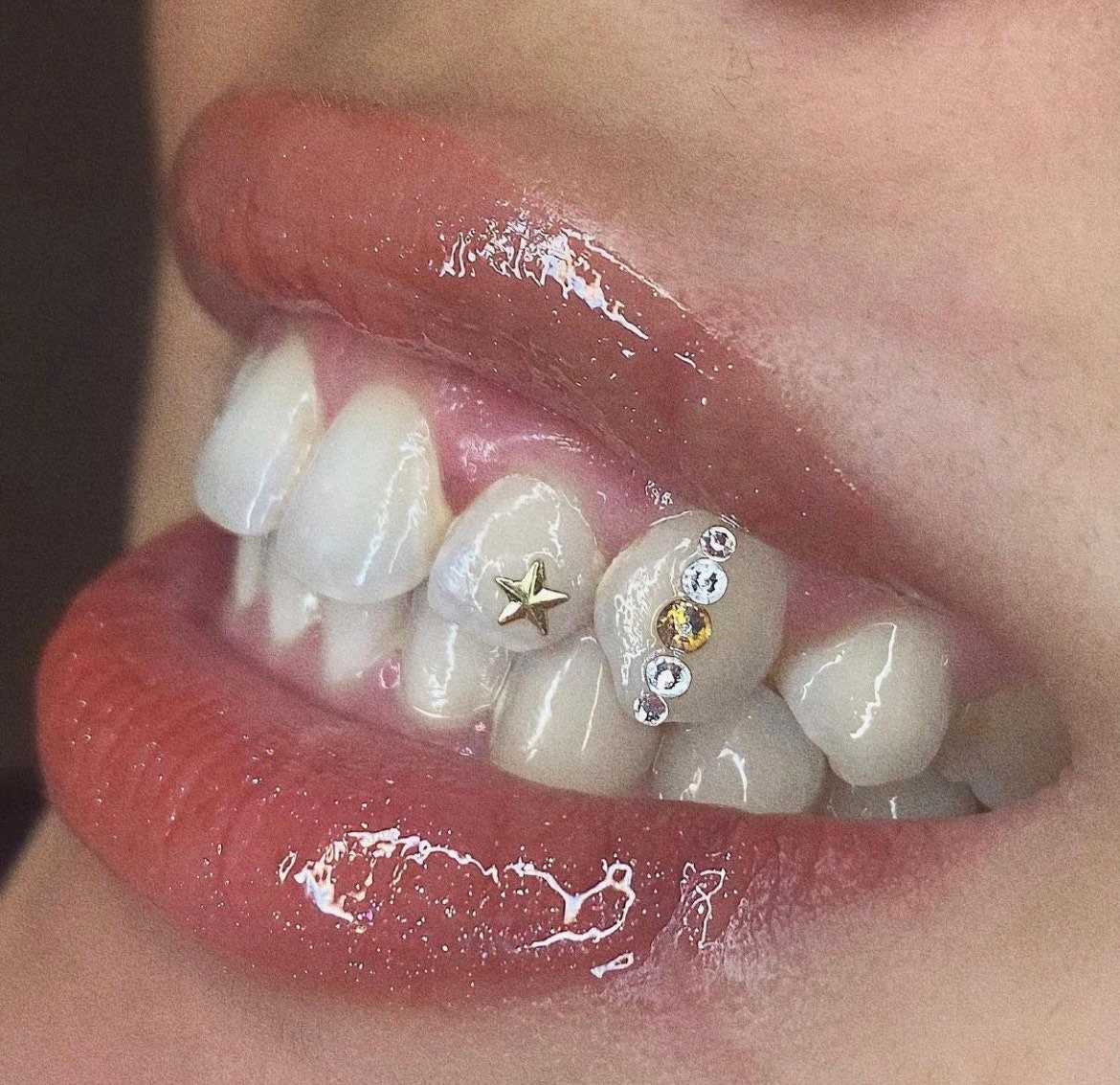 Swarovski and 18Karat Gold Tooth Gems — Your Smileologist