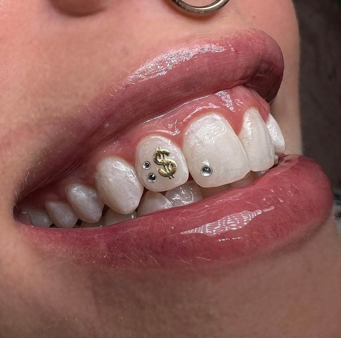 Tooth Gems — ARCH & EDGE