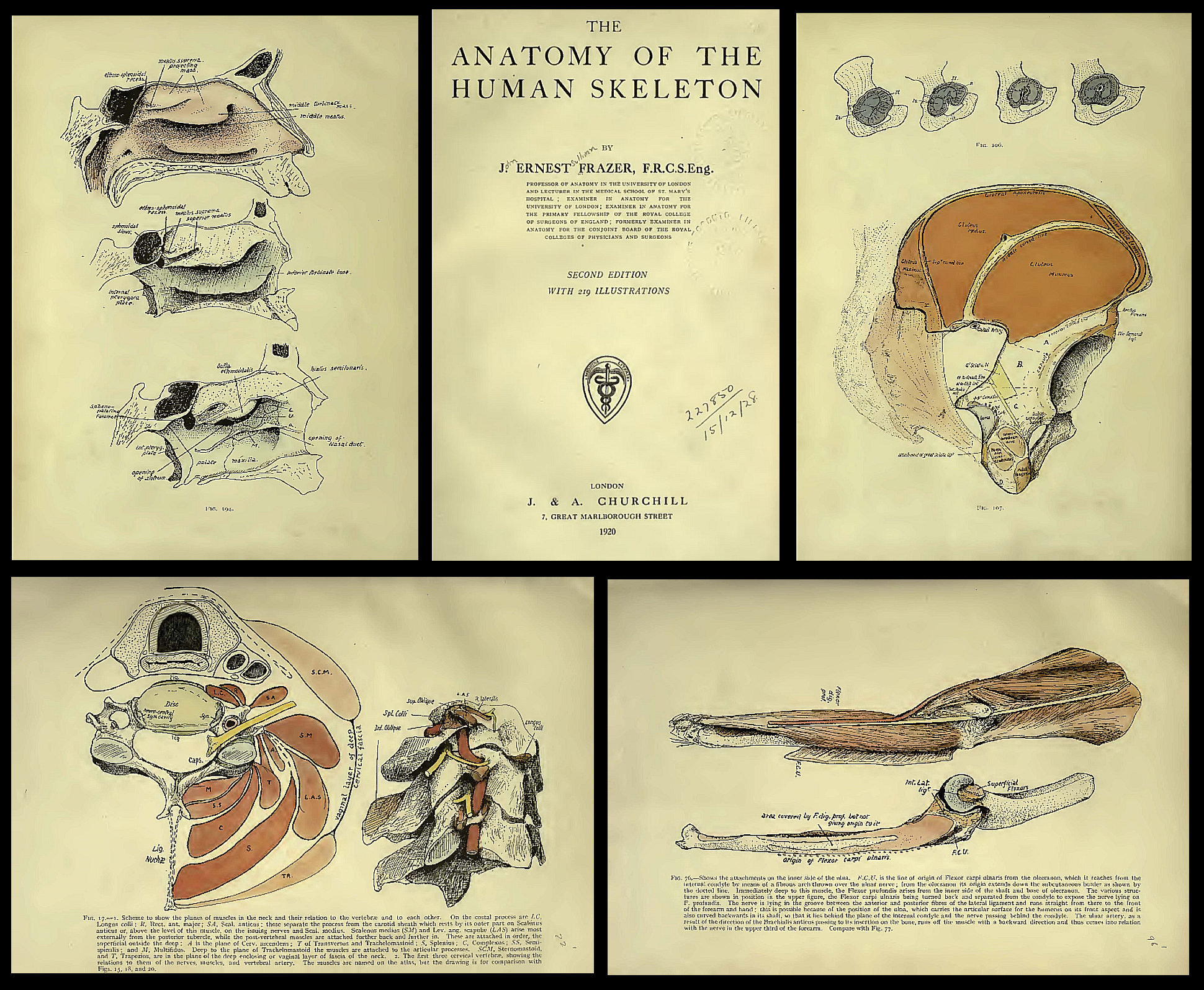 140 PATHOLOGY BOOKS: Post-mortem, Autopsy, Anatomy, Rare Vintage ...