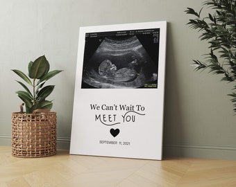 Love at First Sight Canvas, Expecting Mom Gift, Ultrasound Photo Canvas, Gift for New Moms, Mom to be Gift idea, First Time Expectant Mom