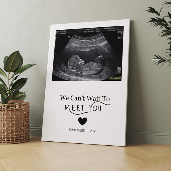 Love at First Sight Canvas, Expecting Mom Gift, Ultrasound Photo Canvas, Gift for New Moms, Mom to be Gift idea, First Time Expectant Mom