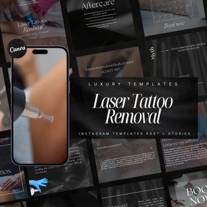 80  Laser Tattoo Removal Instagram Templates | Tattoo Removal Social Media Posts | PMU laser removal templates  | Tattoo Removal Posts