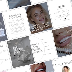 May include: A collection of informational posters about teeth whitening. The posters feature text and graphics, including a timeline, everyday habits, and foods that stain teeth. The color scheme is primarily black and white.
