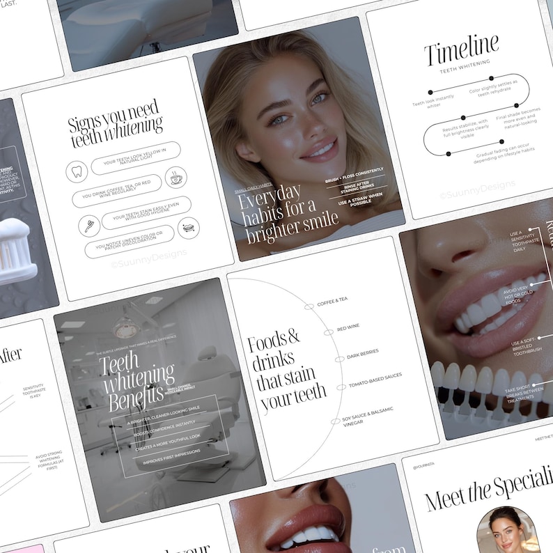 May include: A collection of informational posters about teeth whitening. The posters feature text and graphics, including a timeline, everyday habits, and foods that stain teeth. The color scheme is primarily black and white.