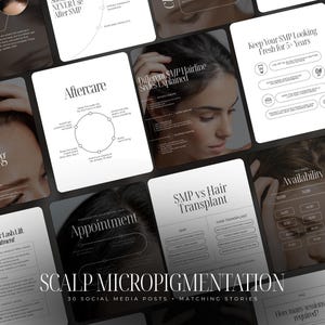 Scalp Micropigmentation Instagram Templates | Pmu Instagram template | SMPTemplates | PMU Social Media Post | SMP Instagram Post | Scalp PMU