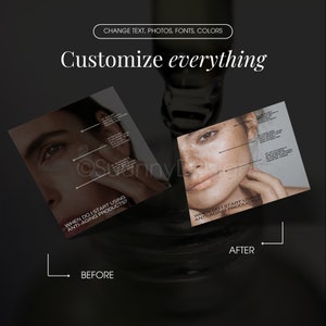 May include: Before and after images showing the effects of using anti-aging products. The image on the left shows a person's face with visible wrinkles and fine lines. The image on the right shows the same person's face with smoother skin and fewer wrinkles. The text on the images reads "When do I start using anti-aging products?"