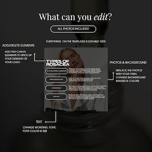 May include: A graphic explaining the different types of rosacea, a skin condition. The graphic includes a photo of a woman with rosacea, and text describing the four types: Erythematotelangiectatic, Papulopustular, Phymatous, and Ocular.
