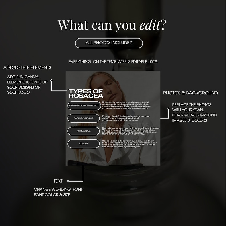 May include: A graphic explaining the different types of rosacea, a skin condition. The graphic includes a photo of a woman with rosacea, and text describing the four types: Erythematotelangiectatic, Papulopustular, Phymatous, and Ocular.