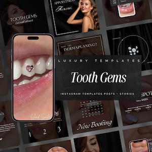 80 Tooth Gem Instagram-sjablonen | Tandsieraden Berichten | Tandbedels sociale media postsjabloon | Tandheelkundige sieraden Instagram-sjabloon