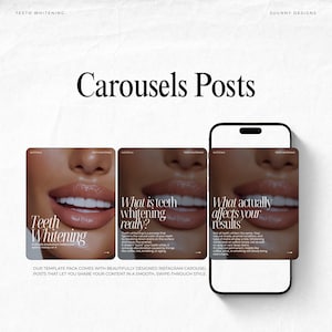 May include: A digital mockup of a smartphone displaying three Instagram carousel posts about teeth whitening. The posts feature close-up images of a person's mouth and teeth, with text overlaying the images. The posts are titled "Teeth Whitening", "What is teeth whitening really?", and "What actually affects your results?"