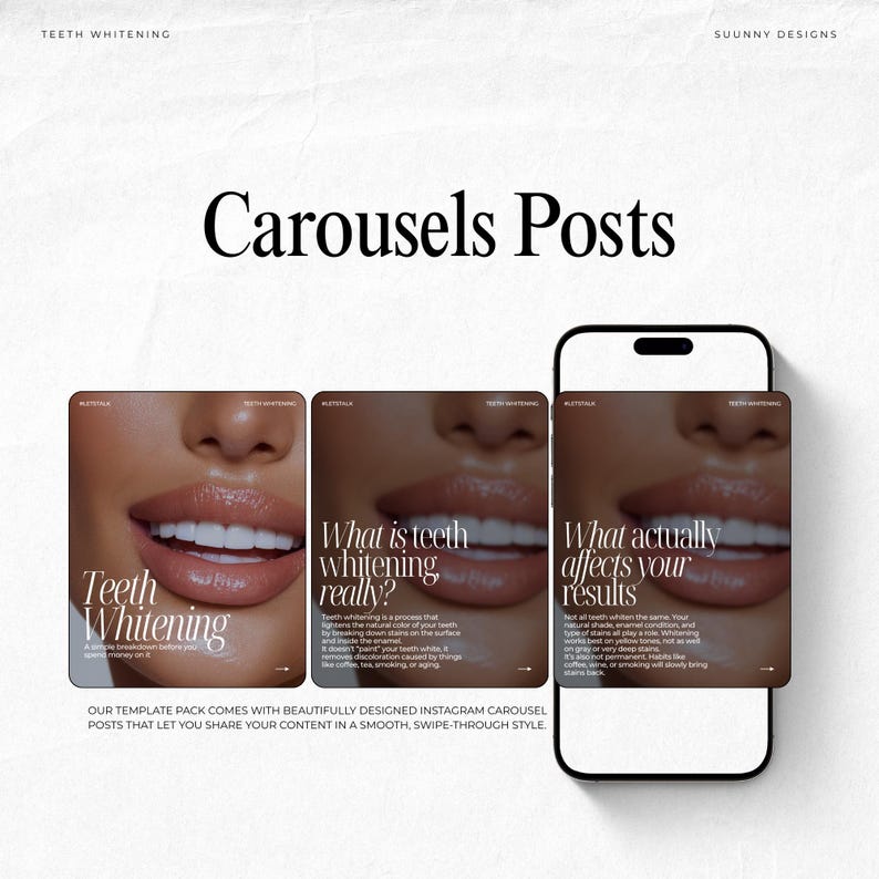 May include: A digital mockup of a smartphone displaying three Instagram carousel posts about teeth whitening. The posts feature close-up images of a person's mouth and teeth, with text overlaying the images. The posts are titled "Teeth Whitening", "What is teeth whitening really?", and "What actually affects your results?"