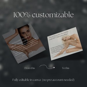 May include: Two images showing a customizable template for a social media post. The template is for a business that offers RF Microneedling treatments. The text on the template reads "Treat Excessive Sweating with RF Microneedling". The template is fully editable in Canva, and no pro account is needed.