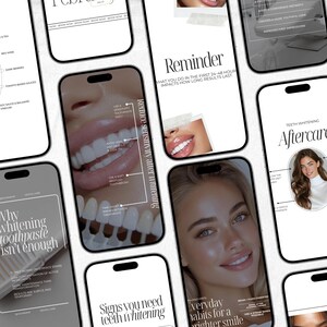 May include: A collection of smartphones displaying information about teeth whitening. The screens feature text like "Reminder," "Aftercare," and "Everyday habits for a brighter smile." Images of teeth and smiling faces are also visible.