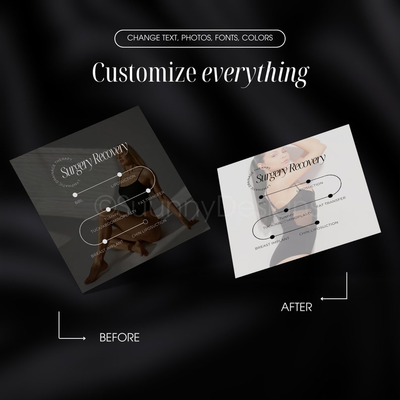 May include: Before and after images of a woman's body with circles highlighting different areas where surgery recovery is possible. The areas include breast implant, tummy tuck, chin liposuction, liposuction, and fat transfer. The text "Surgery Recovery" is displayed on both images.