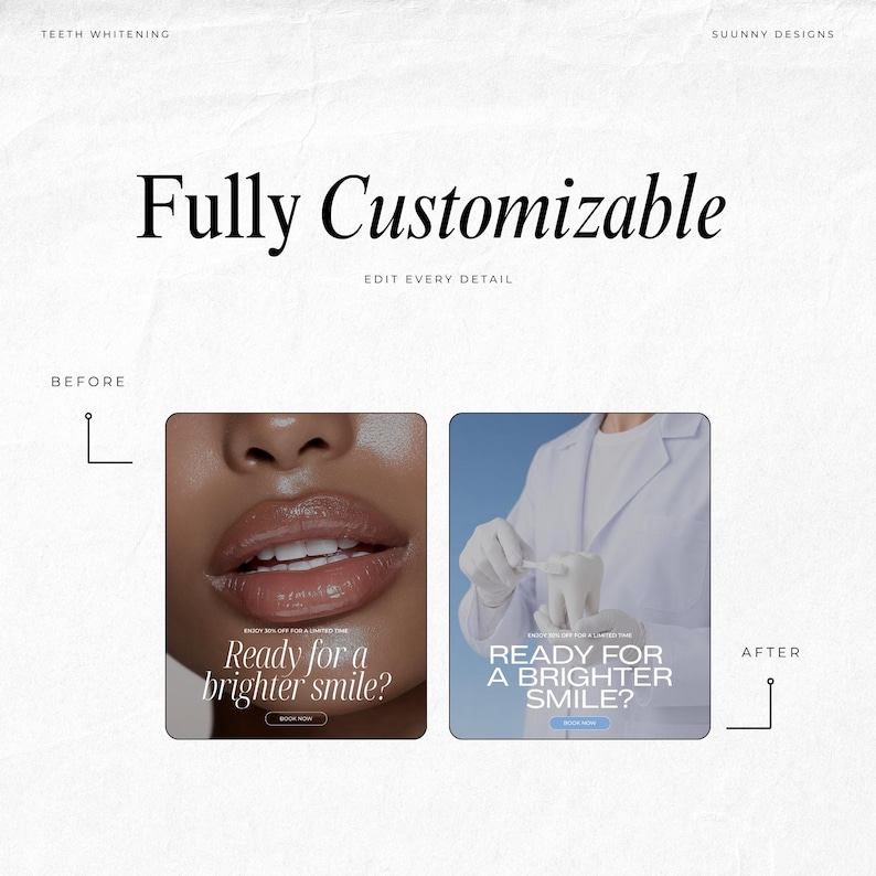May include: A promotional graphic for teeth whitening services. The text "Fully Customizable" is displayed in a large, elegant font. Two images show a before-and-after comparison, with the text "Ready for a brighter smile?" on each.