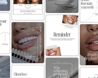 Teeth Whitening Instagram Templates | LED teeth whitening  Templates | Teeth Whitening Post | Teeth Whitening Social Media Post Template