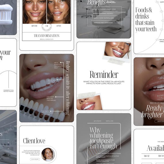 Teeth Whitening Instagram Templates | LED teeth whitening  Templates | Teeth Whitening Post | Teeth Whitening Social Media Post Template