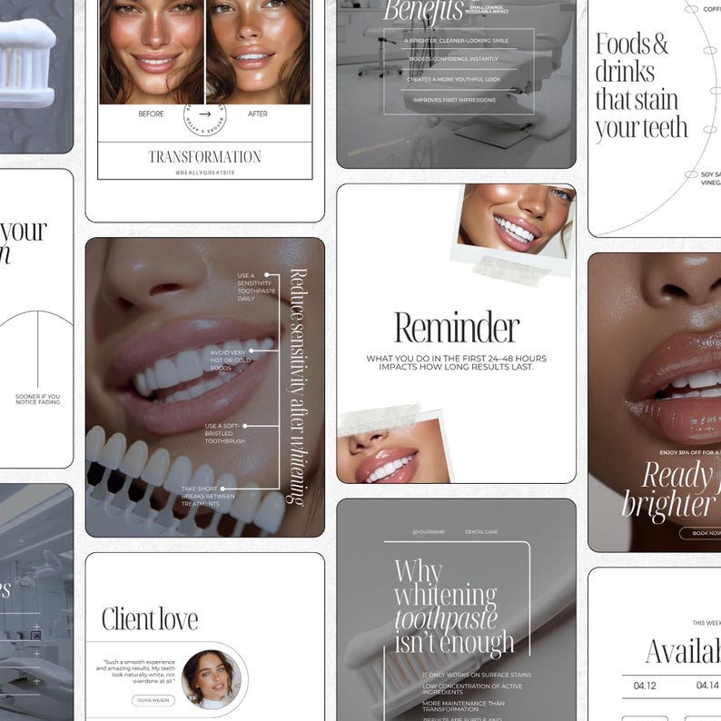 May include: A collage of images promoting teeth whitening. The images include before and after photos, a close-up of teeth with a shade guide, and text about the benefits and reminders for whitening. The color scheme is neutral with white and beige.