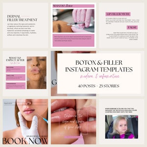 Botox and Filler Instagram Templates | Injector Posts | Beauty Template | Botox | Lip & Dermal Fillers | Canva Templates |Social Media Posts