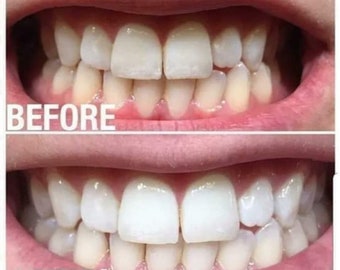 AP 24 Whitening Toothpaste