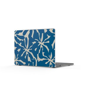 Può includere: Un laptop con una custodia a fantasia floreale blu e crema. La custodia presenta un motivo ripetuto di forme astratte. La parola "VAULT" è stampata sulla custodia. Il laptop è aperto e leggermente angolato.